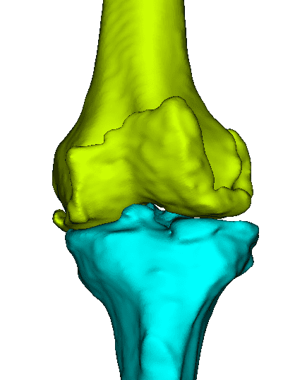 Knee CT scan preview